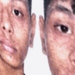 aarydr