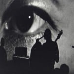 lobotomy